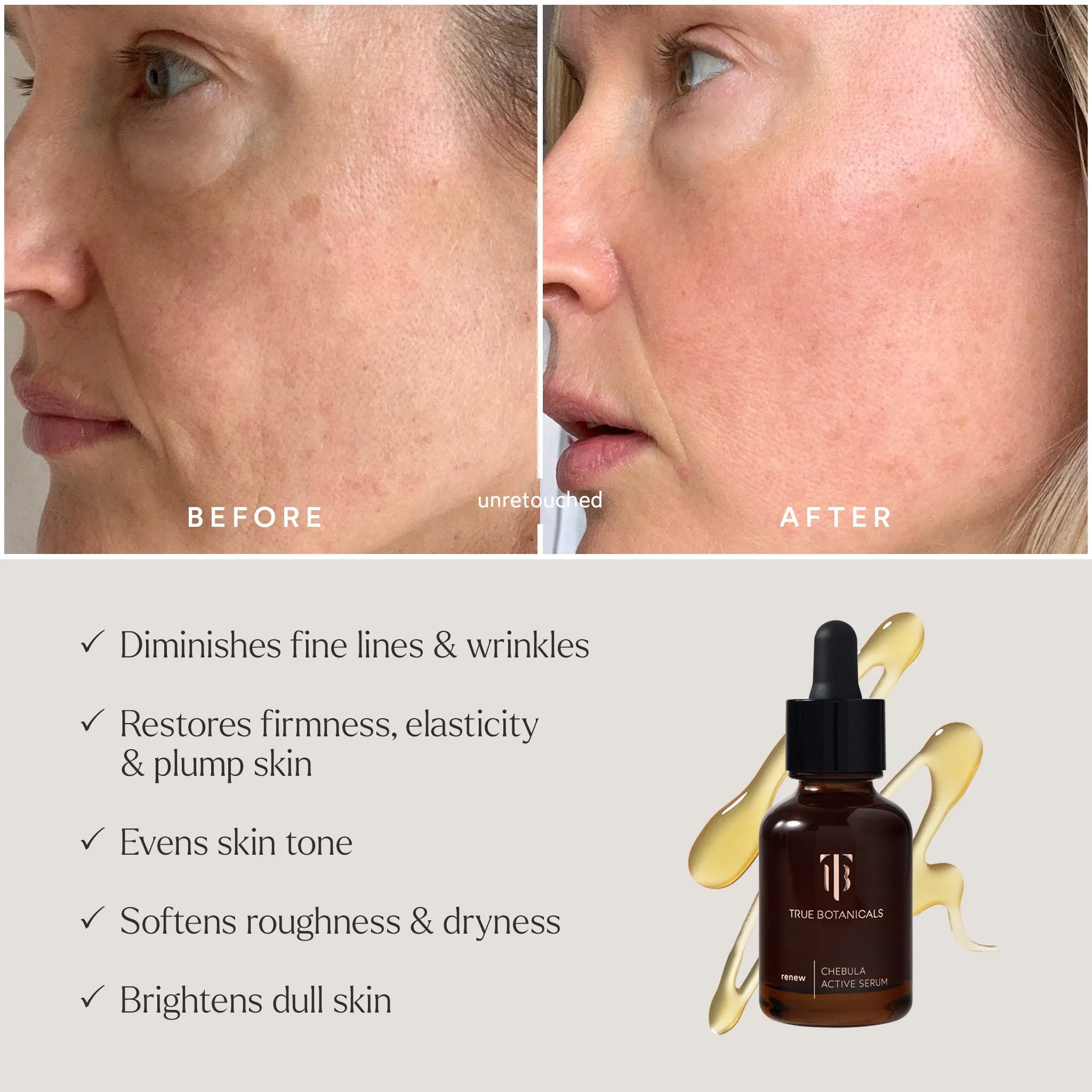 Deep Hydration Renewal–3 Piece Daily Essentials