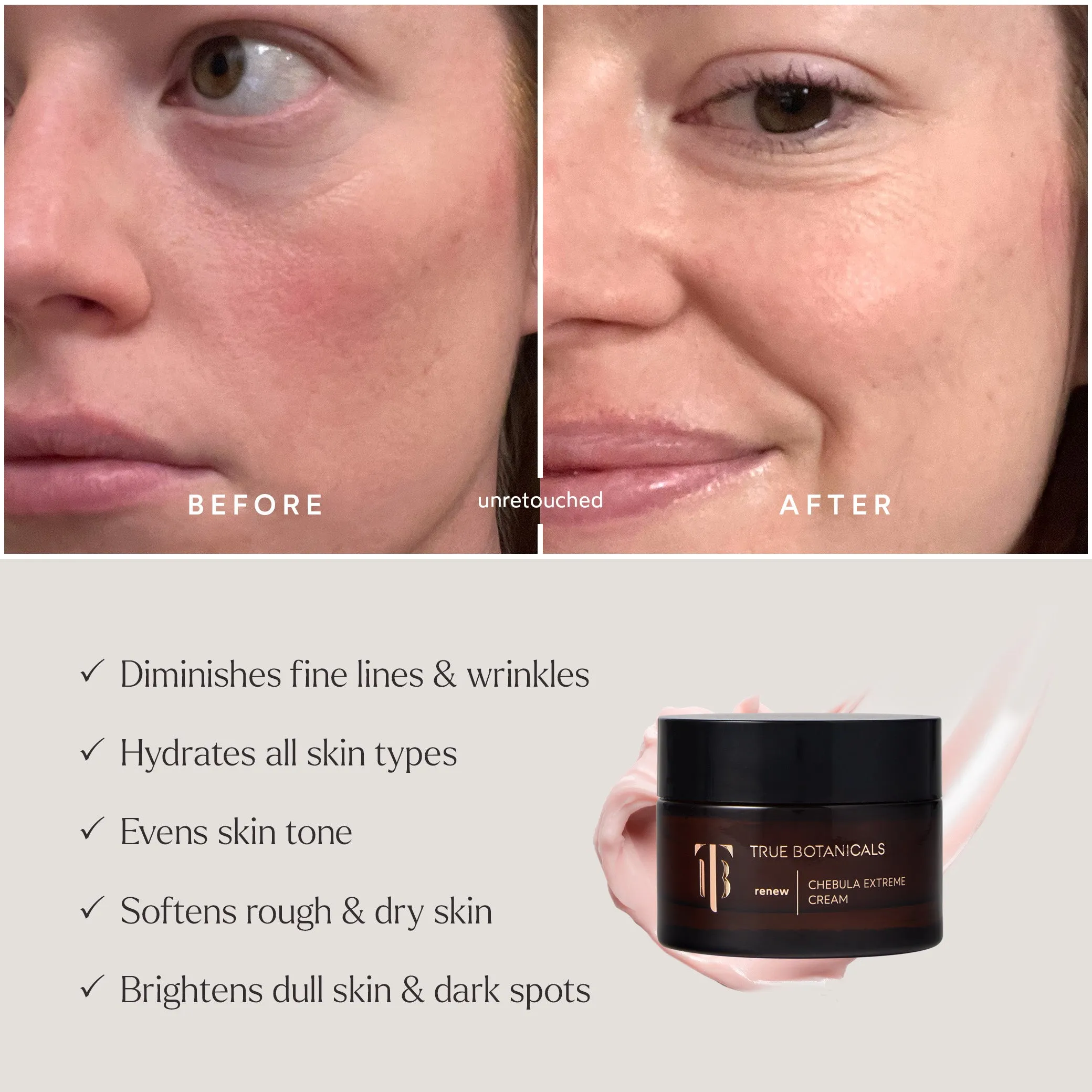 Deep Hydration Renewal–3 Piece Daily Essentials